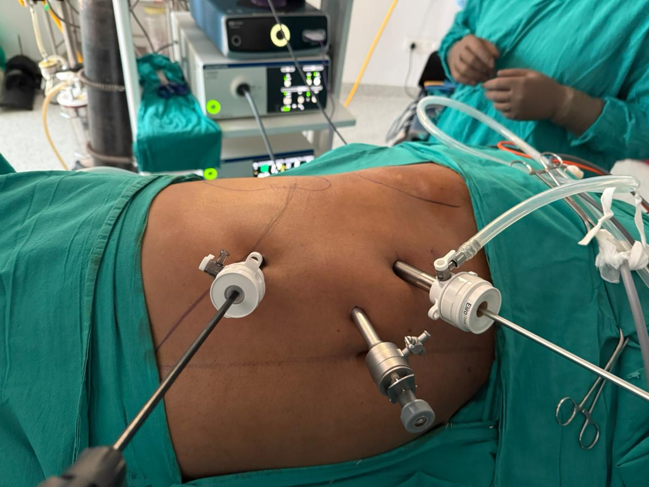 Advanced Cancer Surgery Clinic Images 15