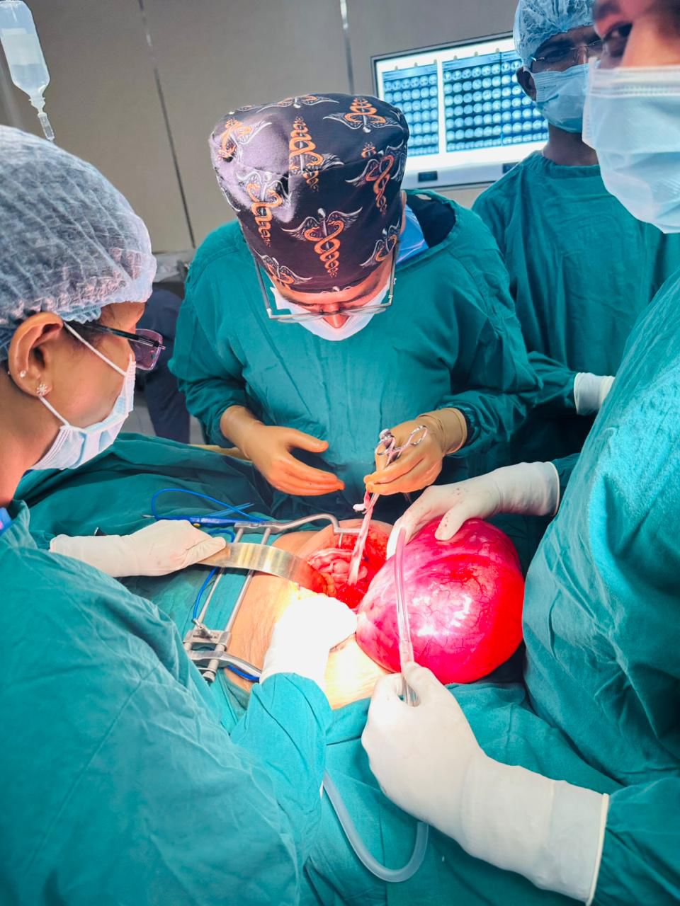 Advanced Cancer Surgery Clinic Images 6